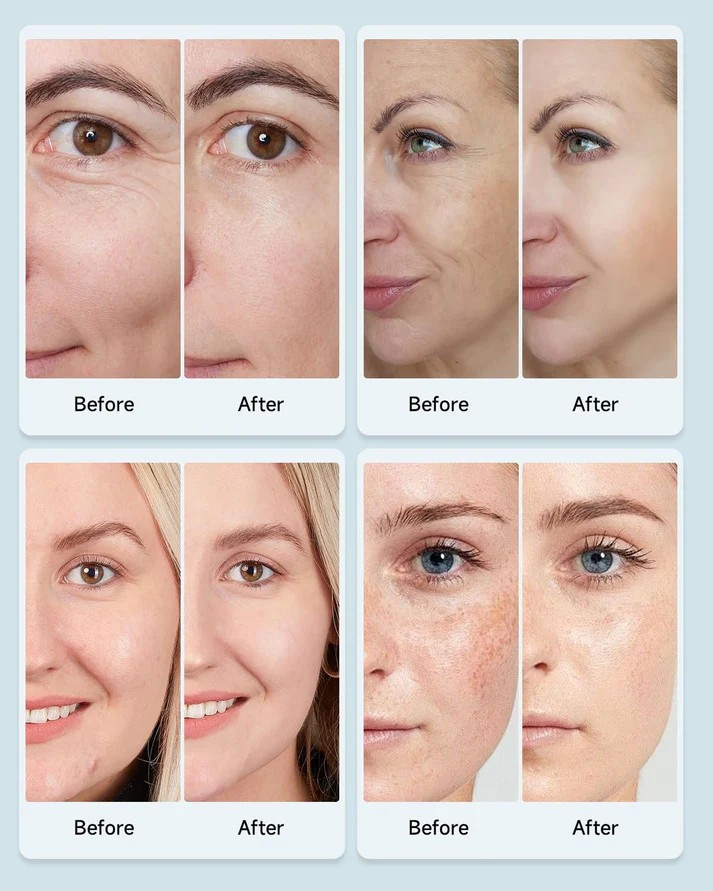 LED-mask Reach FC1 - Image 4